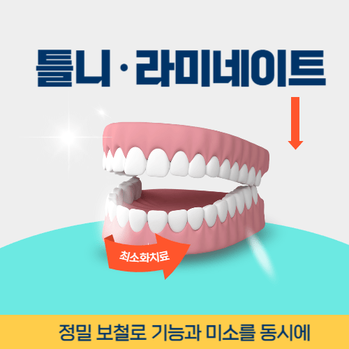 이천치과 이천시 치과 틀니 라미네이트