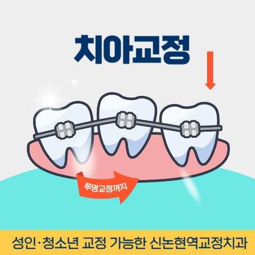 이천치과 이천시 치과 치아교정