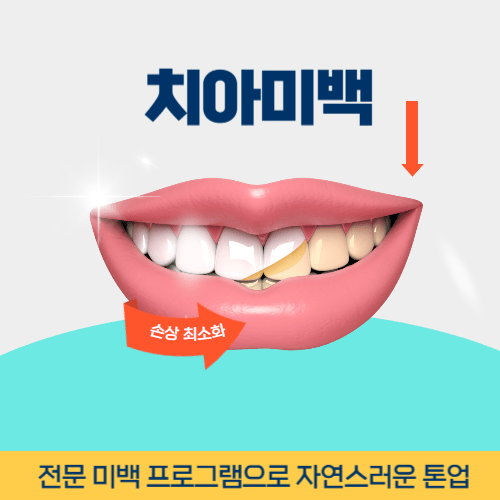 이천치과 이천시 치과 치아미백