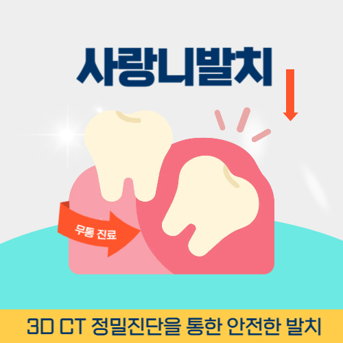 이천치과 이천시 치과 사랑니 발치