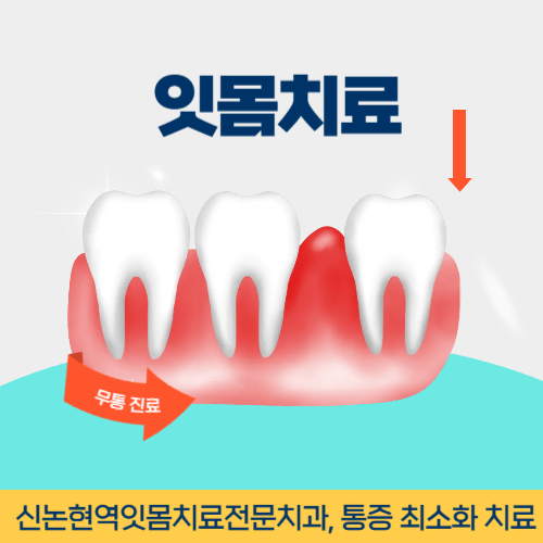 이천치과 이천시 치과 잇몸치료